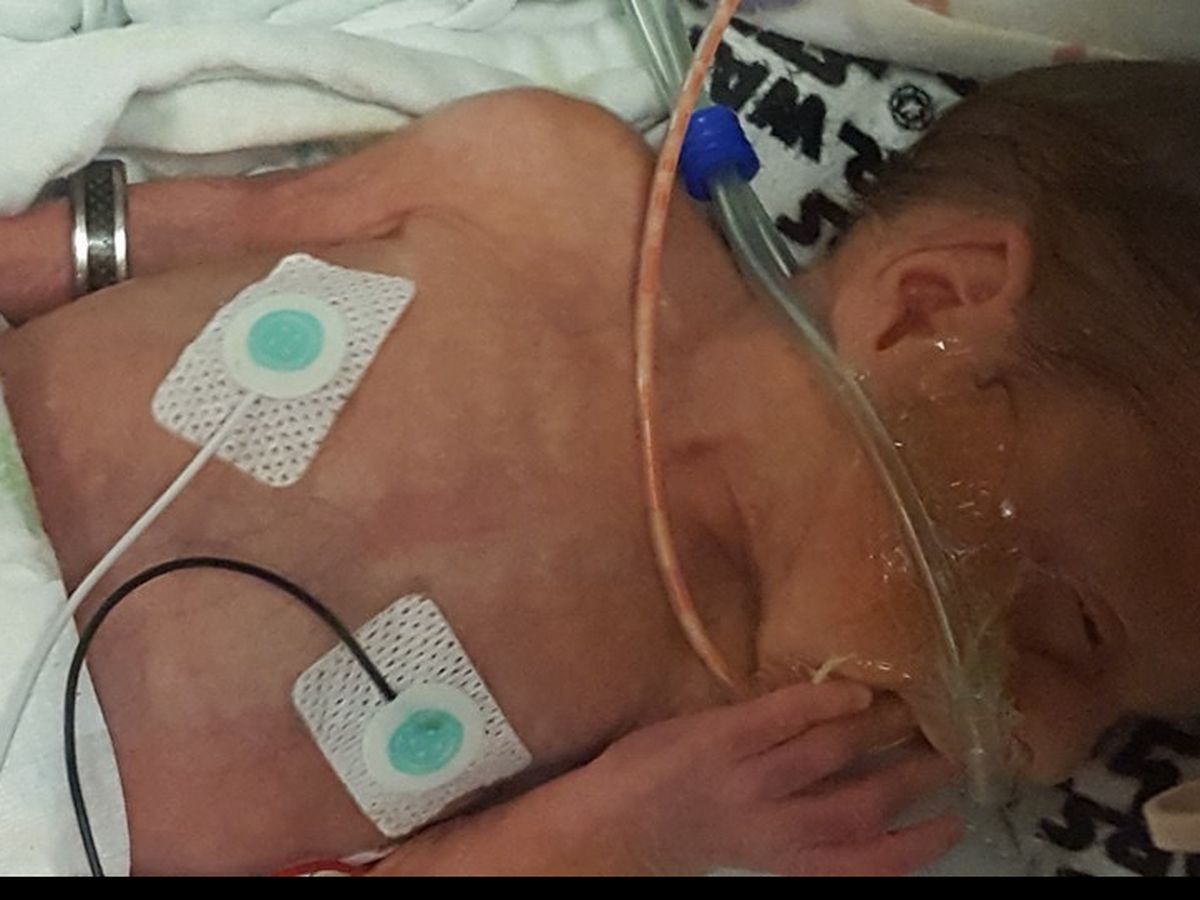Help Ben Thrive with Neurofeedback Therapy campaign photo, 1 of 7