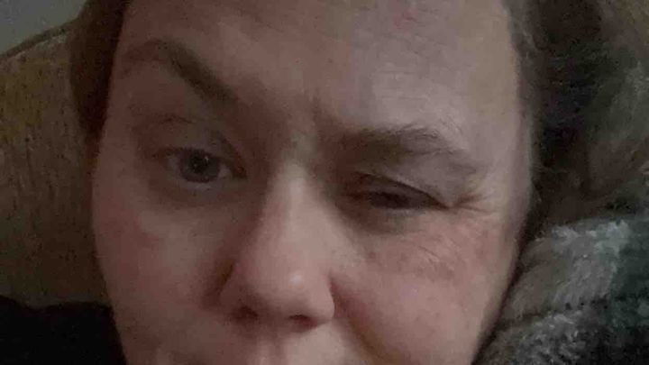 Help with Medical Bills and Loss of Income campaign photo, 1 of 5