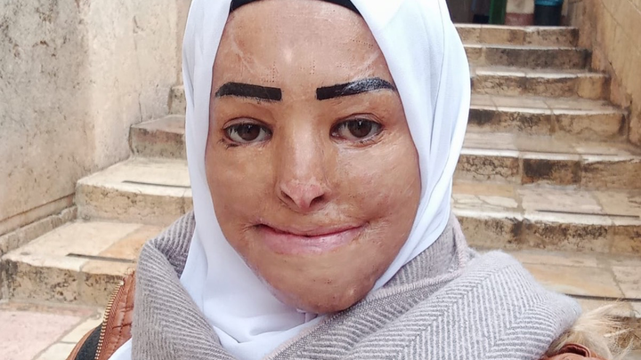 Donate to Transform Hedaya's Life campaign photo, 1 of 6