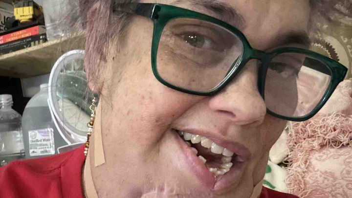 Help Aileen Recover from Oral Cancer campaign photo, 1 of 4