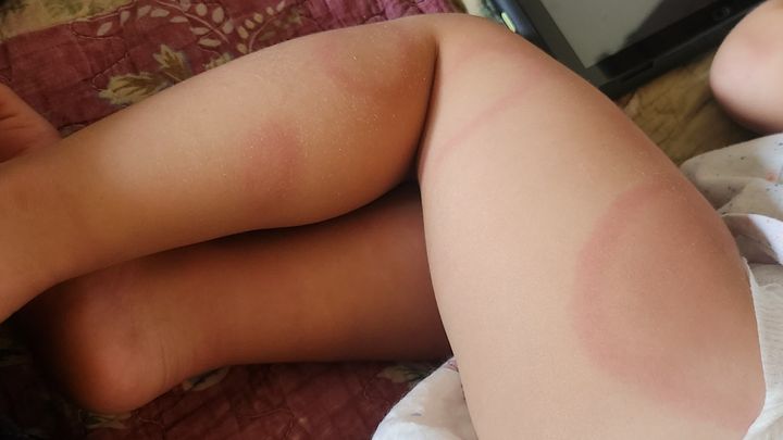 Foto principal da arrecadação de fundos