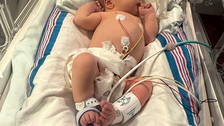 Elijah Paul Pote’s Hirschsprung’s disease campaign photo, 1 of 5