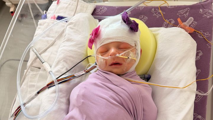 Baby Lennon’s ICU Journey campaign photo, 1 of 8