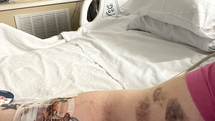 Support Rachel’s Recovery and Medical Care campaign photo, 1 of 7