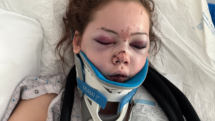 Donate to help Eloise Vermouth heal from ATV accident campaign photo, 1 of 6