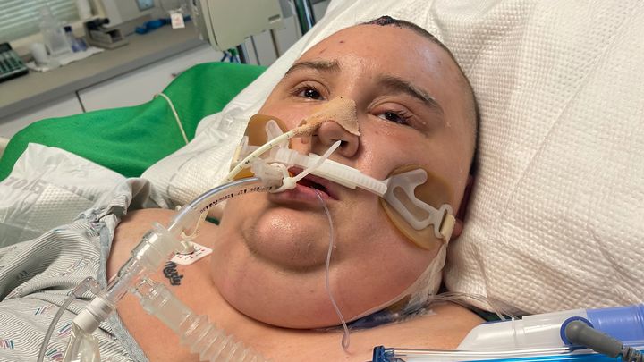 Sinus infection to the brain campaign photo, 1 of 2