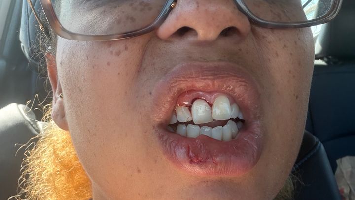Help Save My Teeth After a Freak Accident campaign photo, 1 of 7