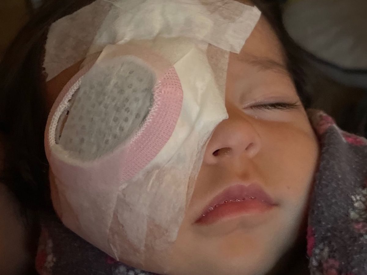 Help for Baby Iries sight recovery ❤️ campaign photo, 1 of 2