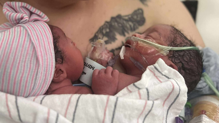 Support Emmilee and Her Premature Twins Harper and Hazel campaign photo, 1 of 8