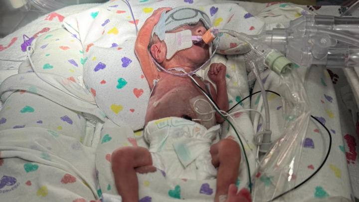A Lion’s Legacy, His Twin Brother's NICU Fight campaign photo, 1 of 8