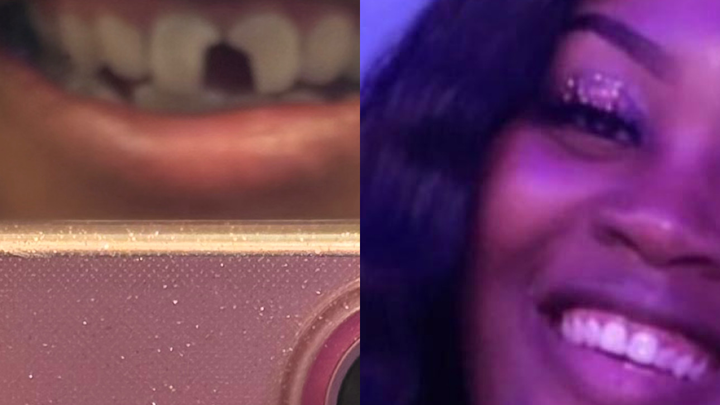 Help Restore a Smile After Medical Incident campaign photo, 1 of 6