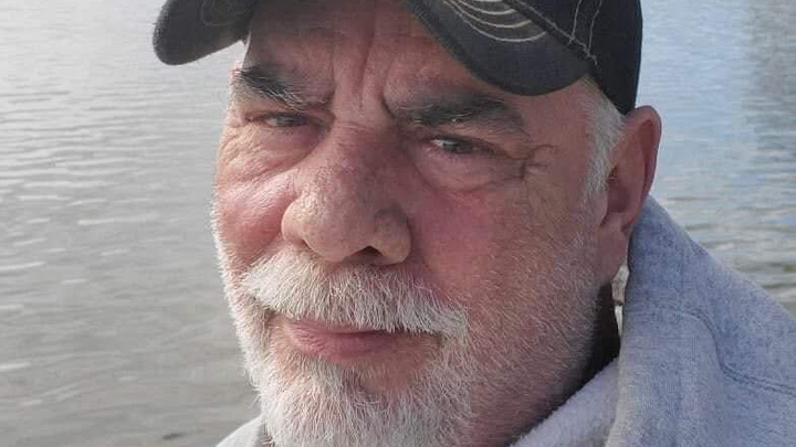 Help Billy while he heals from amputation campaign photo, 1 of 3