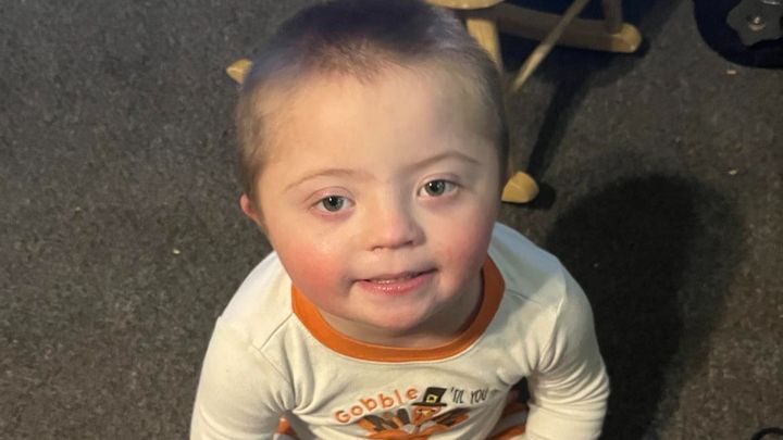 Fundraiser by James Tate : Down Syndrome boy with medical issues