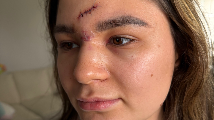 Support Daniela's Friend After Injury campaign photo, 1 of 8