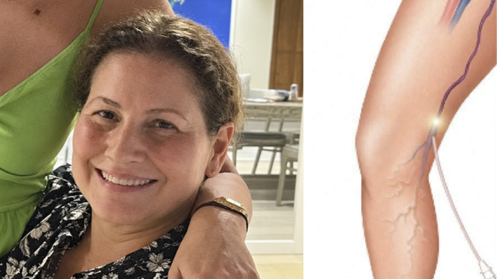 Help my Mother Lucia get Vein Surgery campaign photo, 1 of 4
