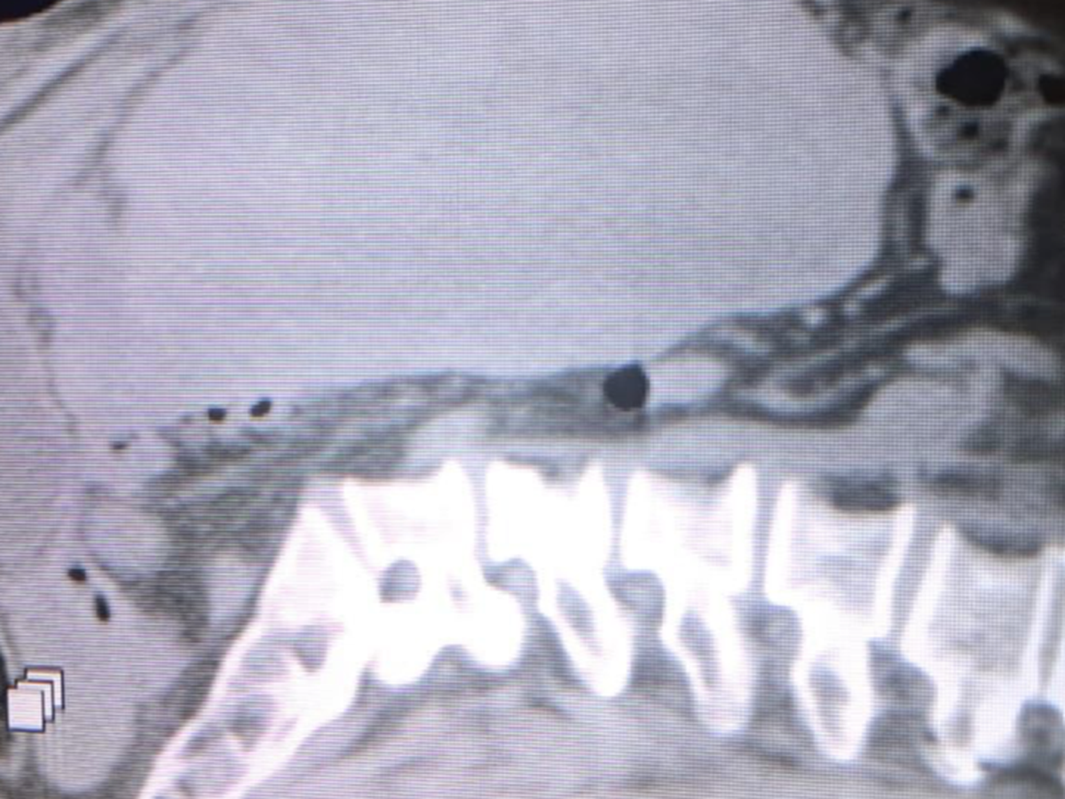 Fundraiser’s main image