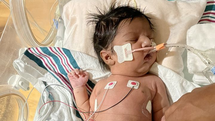 Gabriel's Lung Transplant campaign photo, 1 of 2