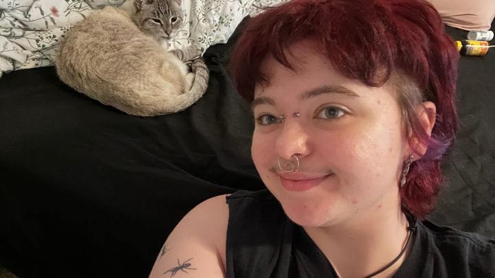 Help Callum get ftm top surgery! campaign photo, 1 of 3