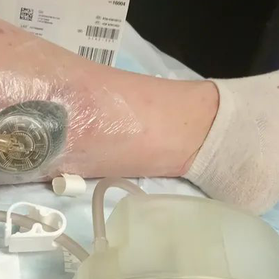 UPDATE! Damsel in Distress!! Wound& Plastics Clinic