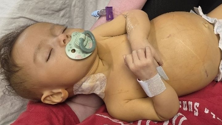 Help Xalia Get A Lifesaving Liver Transplant campaign photo, 1 of 13