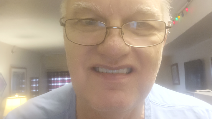 Support Jeff's Urgent Dental Needs campaign photo, 1 of 4