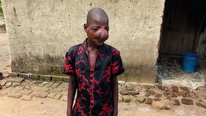 Help Yassa Get Life-Saving Surgery campaign photo, 1 of 6