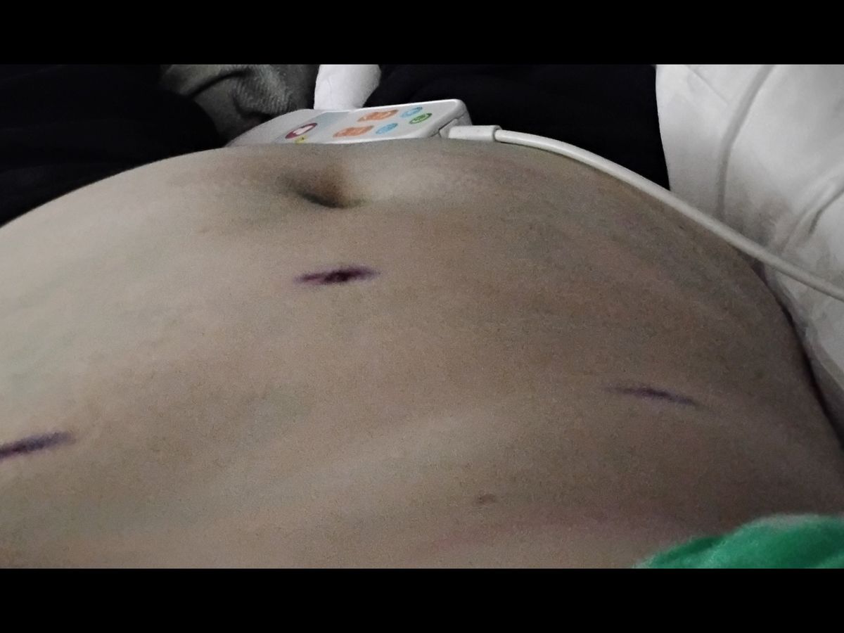 Help Jennifer Heal from Her Emergency Surgery campaign photo, 1 of 7