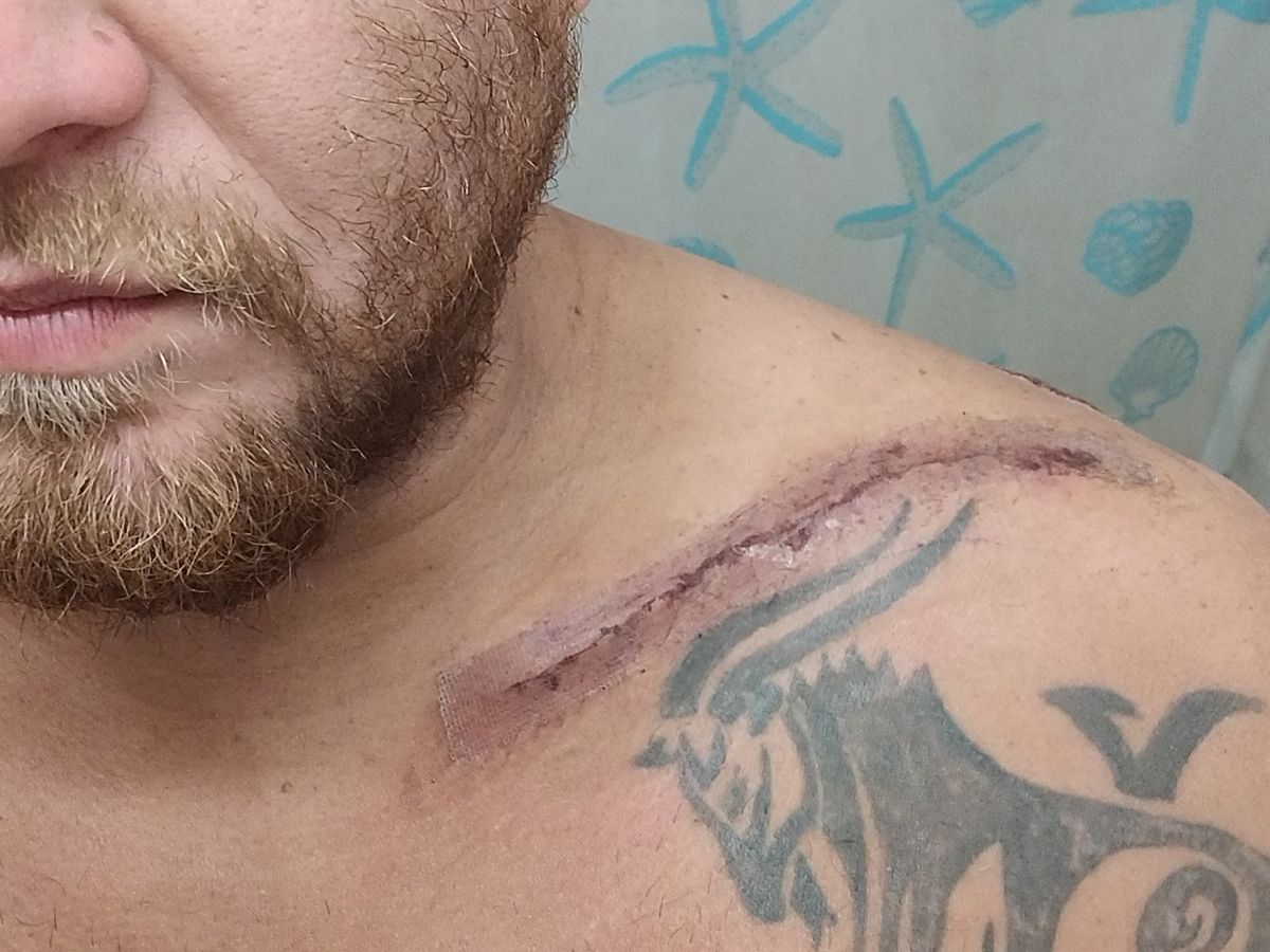 Ebike accident changed my life campaign photo, 1 of 7
