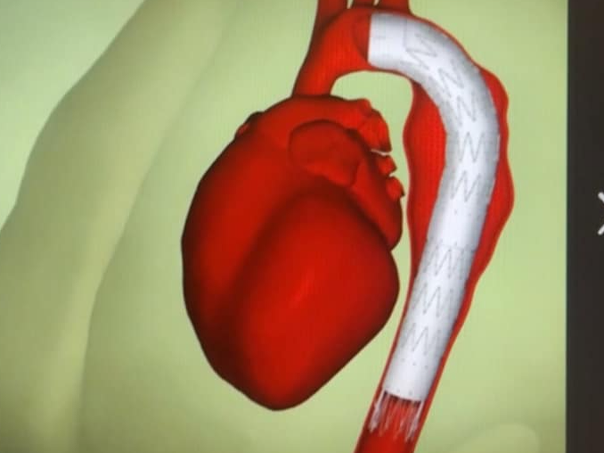 Fundraiser’s main image