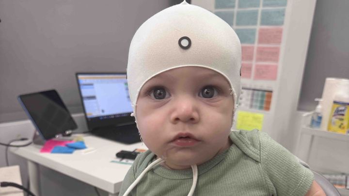 Help our baby get the helmet he needs campaign photo, 1 of 3