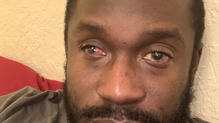 Help Ronsard Jeacinthe Get Medical Treatments campaign photo, 1 of 3