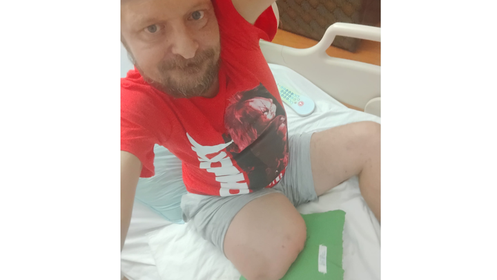 Support for Josh's New Chapter: Embracing Life as an Amputee campaign photo, 1 of 8