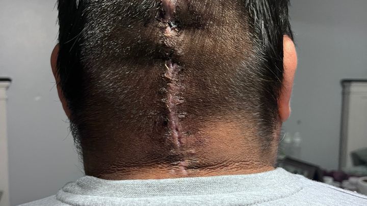 Support Javier's Medical Journey campaign photo, 1 of 6