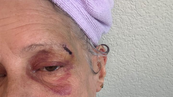 Help Christina Rebuild After Domestic Violence campaign photo, 1 of 3