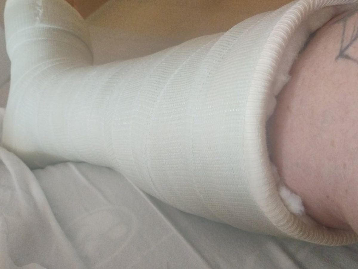 Rob Rast Leg Injury Fundraiser by Robert Gorton : Support for Recovery After Leg Injury