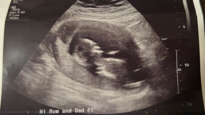 Help Lay Our Angel Baby to Rest campaign photo, 1 of 3