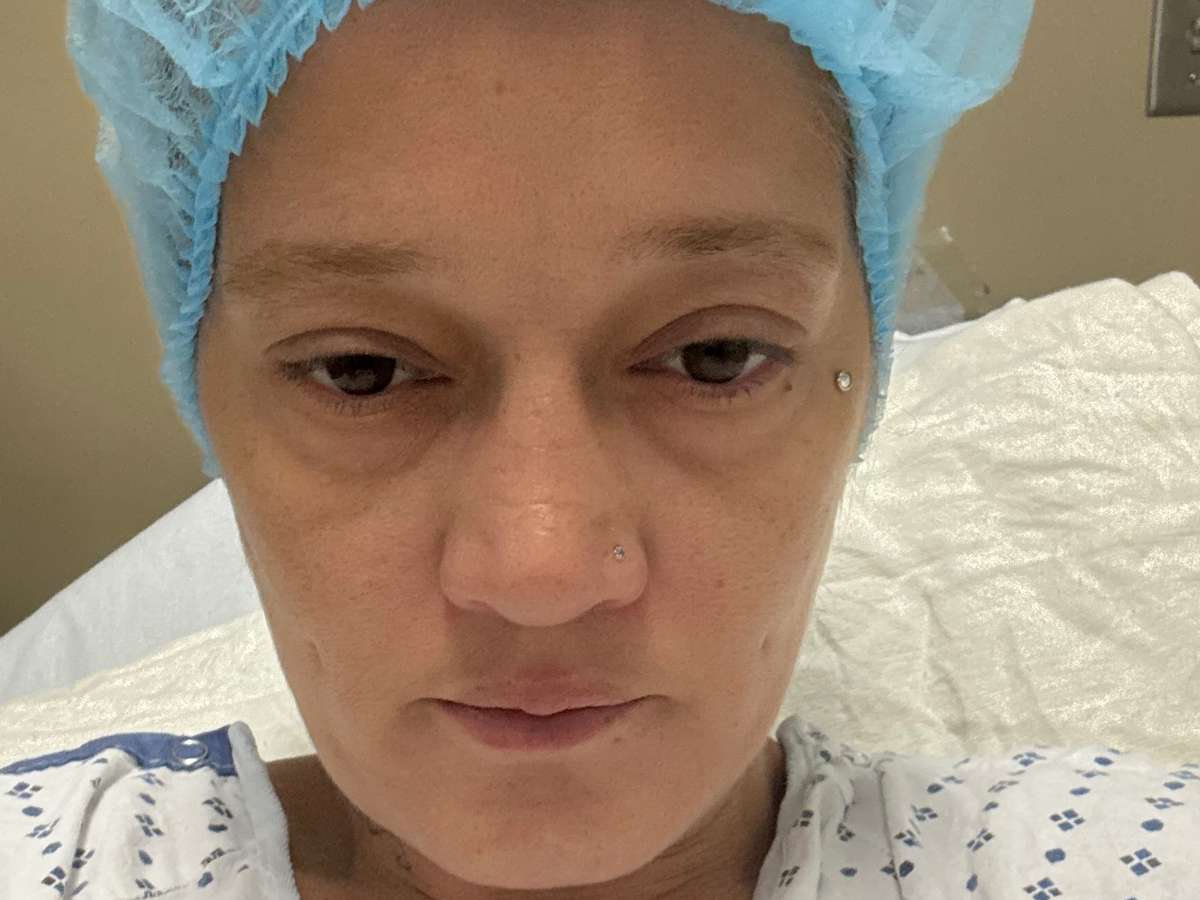 Support Recovery from Diverticulitis Surgery campaign photo, 1 of 8