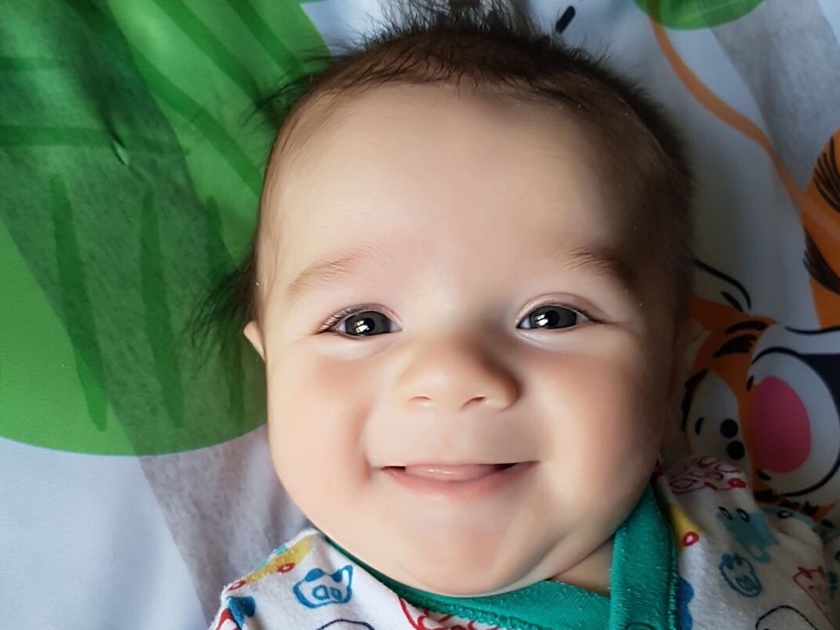 Baby Head Helmet Reshape Head Cost helmet