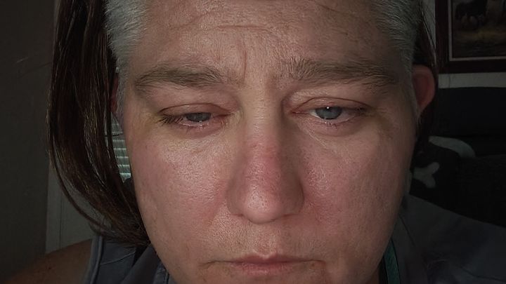 Urgent Help for My Tooth Extraction campaign photo, 1 of 7