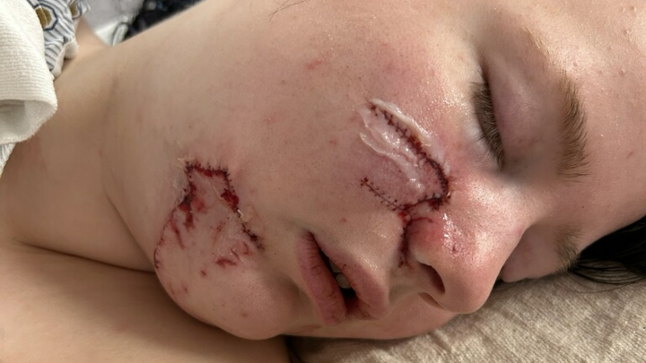 Support Jalyssa's Healing Journey campaign photo, 1 of 4