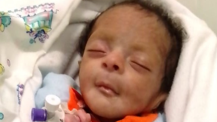 Save Baby Rosiel: Born with Life-Threatening Condition campaign photo, 1 of 4