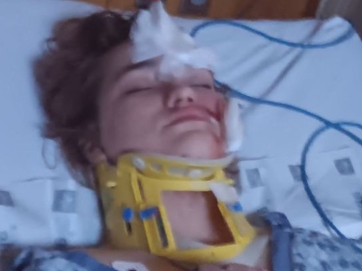 Fundraiser by Melinda Allen : Very injured 11 year old girl