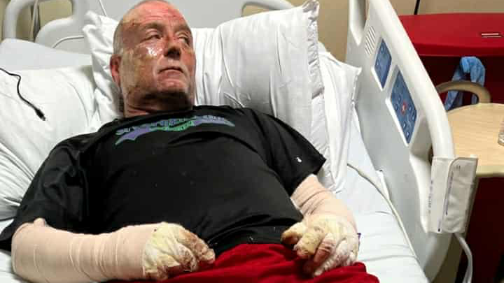 Support Kent's Recovery- House Fire Severe Burns campaign photo, 1 of 8
