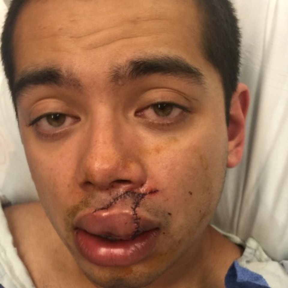 Fundraiser By Edward Centeno Edward Centeno Medical Bills