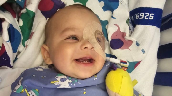 Kampagnen-Foto für Baby Augenoperationen, 1 von 7