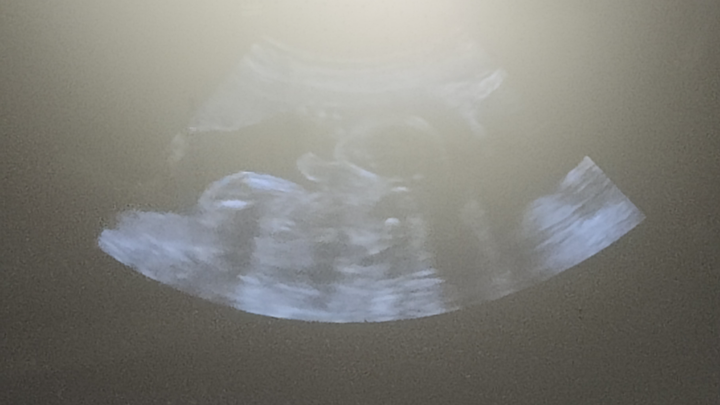 Join Us in Celebrating Our Baby's True Self campaign photo, 1 of 3