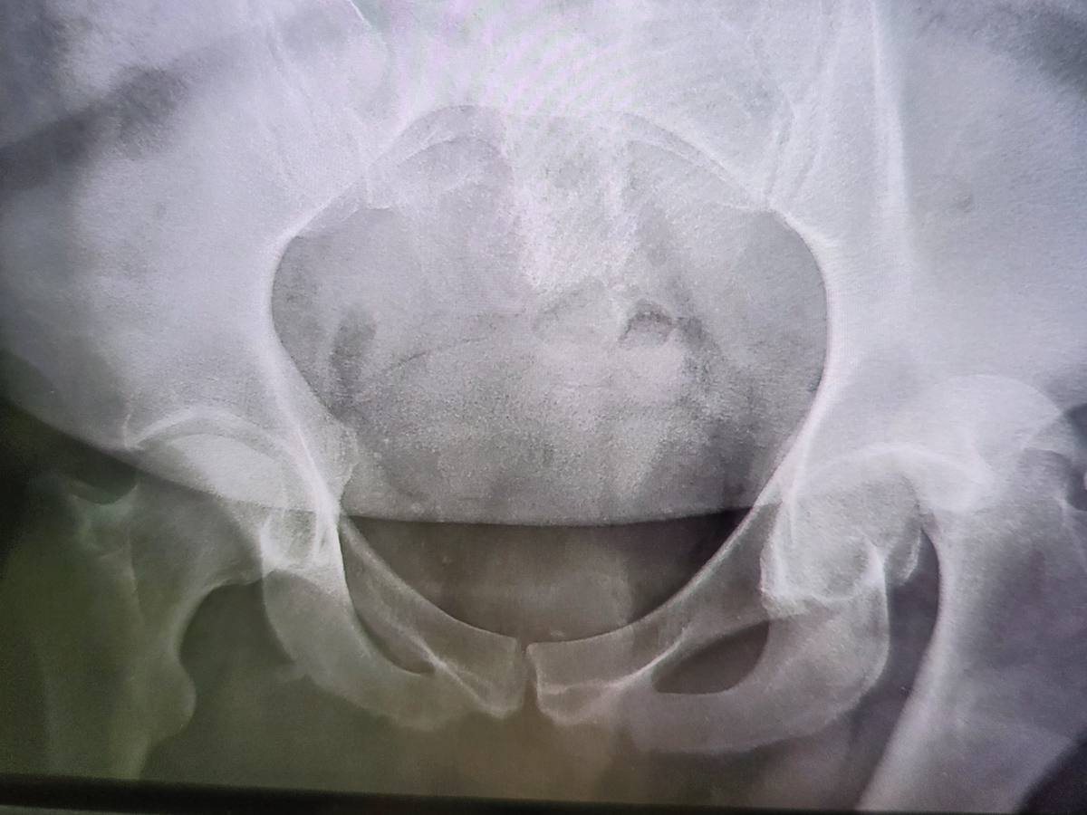 Help Julian Ochoa Recover from Severe Injury campaign photo, 1 of 7