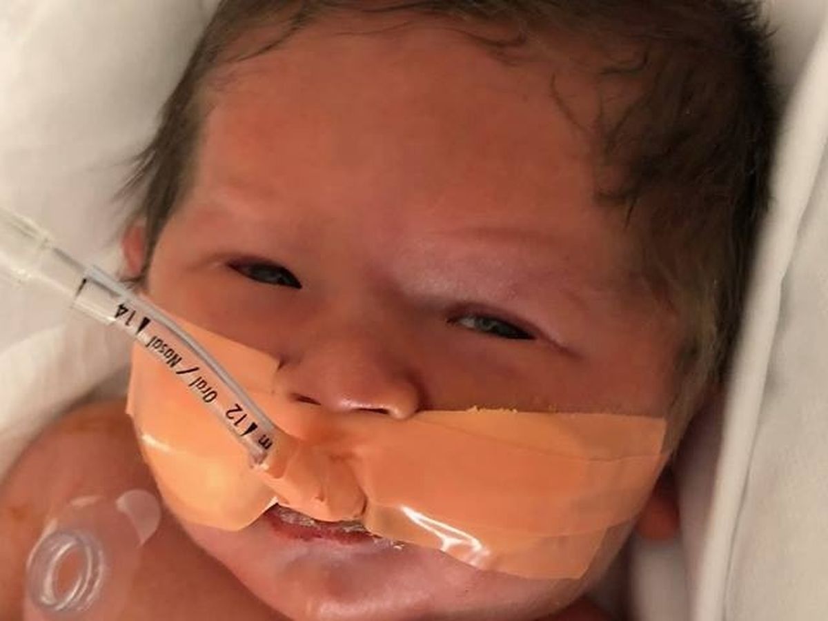 Baby Luke's Story campaign photo, 1 of 3