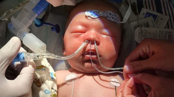 Ryder has Congenital heart Defect campaign photo, 1 of 2