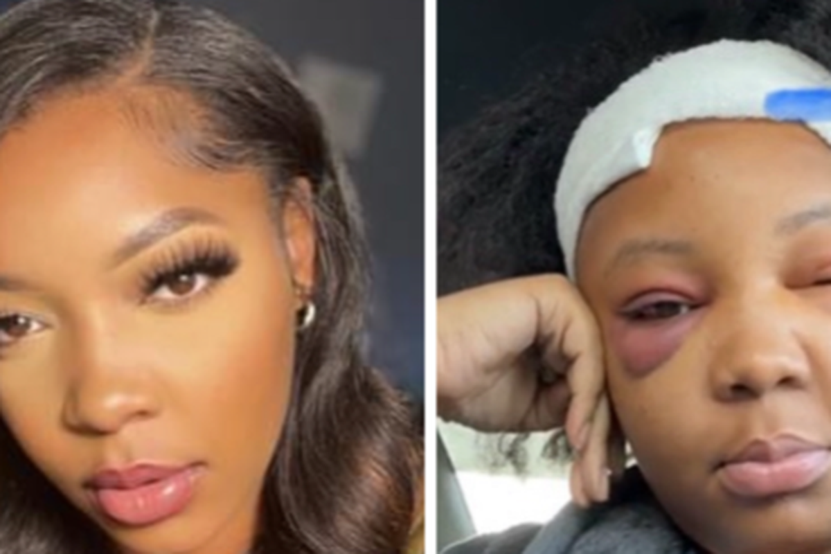 Fundraiser by Tiffany Douglas : Jada Beating Glio